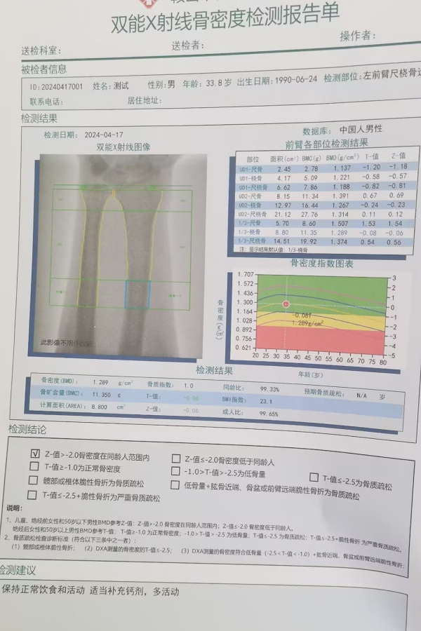 雙能X射線骨密度儀：準(zhǔn)確測(cè)量骨密度，助力骨質(zhì)疏松防治，守護(hù)骨骼健康